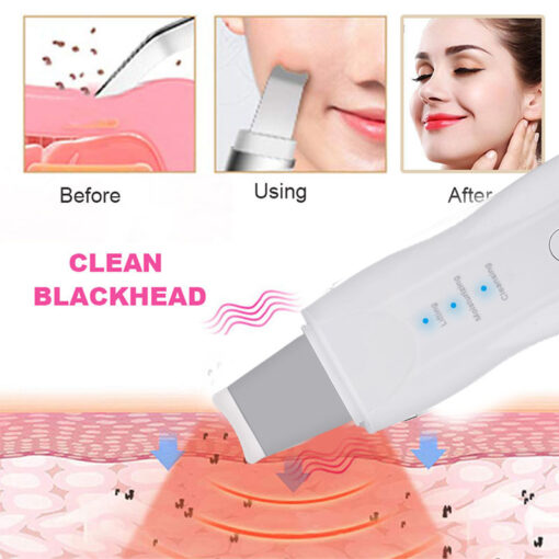 Ultrasonic & Vibration Facial Scrubber - Image 3