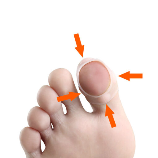 Ingrown Toenail Protector - Image 13