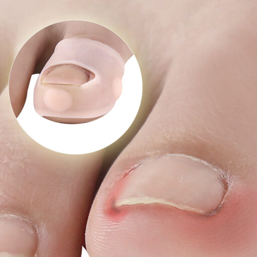 Ingrown Toenail Protector - Image 14