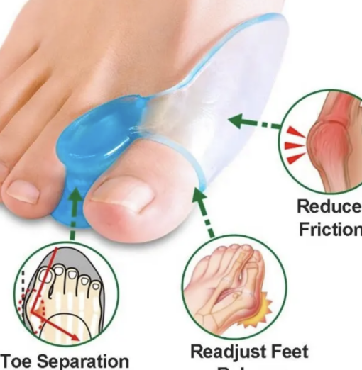 Flexible and Sturdy Toe Corrector - Image 6